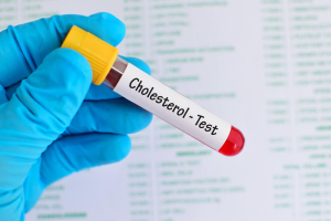 The Role of Cholesterol Tests in Heart Health