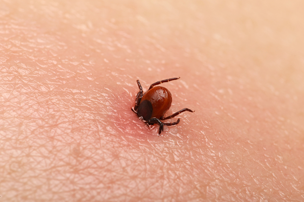 Identifying Infected Insect Bites: Signs, Symptoms and Treatment