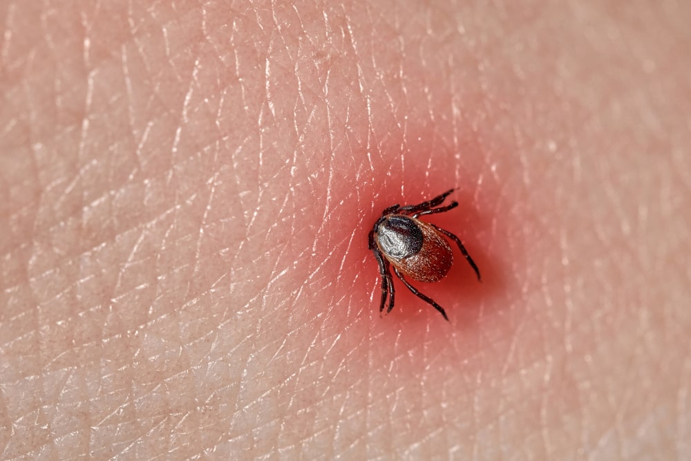 Understanding the Risks of Ignoring an Infected Insect Bite
