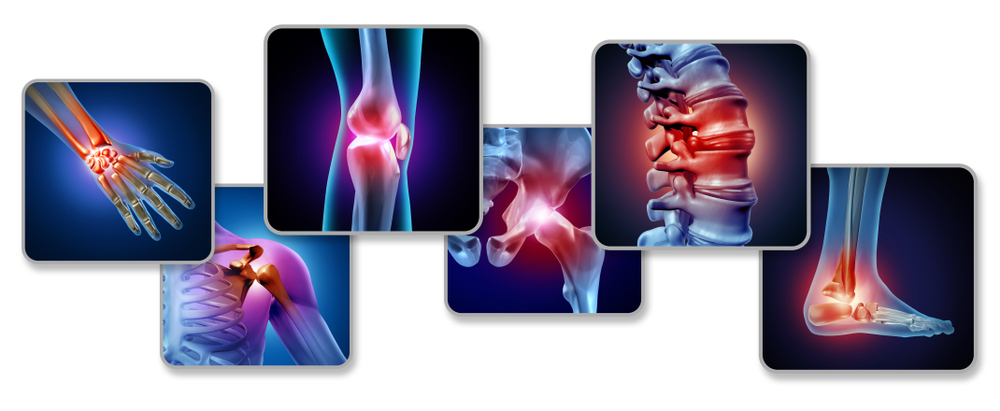 best medicines for joint pain 